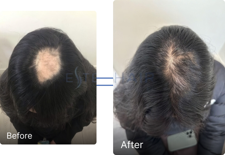 Before and after result 3