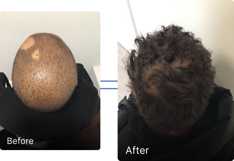 Before and after result 1