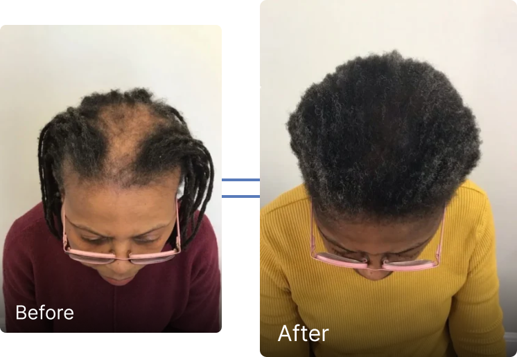 Before and after result 4