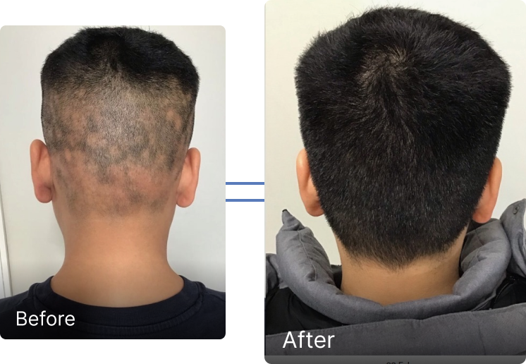 Before and after result 2
